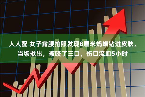 人人配 女子露腰拍照发现8厘米蚂蟥钻进皮肤，当场揪出，被咬了三口，伤口流血5小时